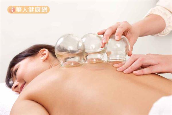 Cupping - increases blood flow and relieves muscle tension
